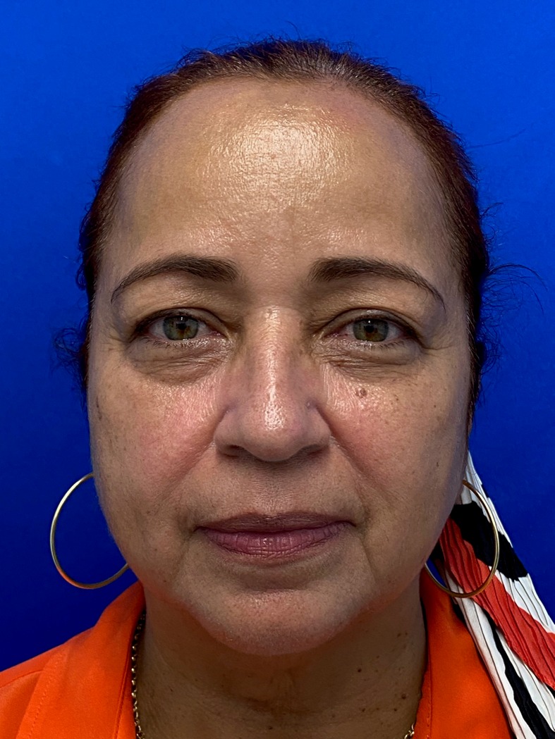 WhatsApp Image 2025-09-26 at 1.45.45 PM