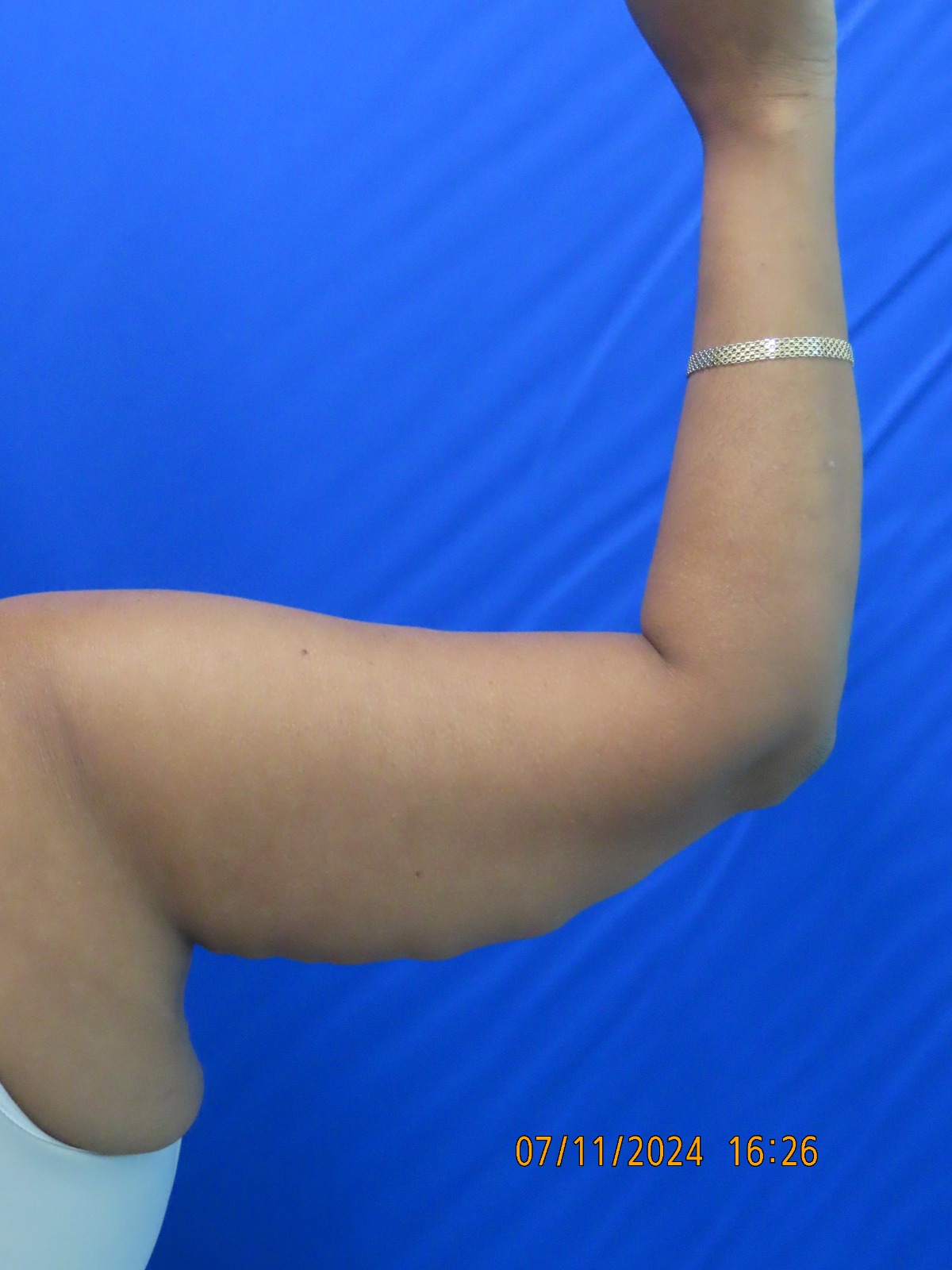 WhatsApp Image 2026-02-26 at 2.04.28 PM