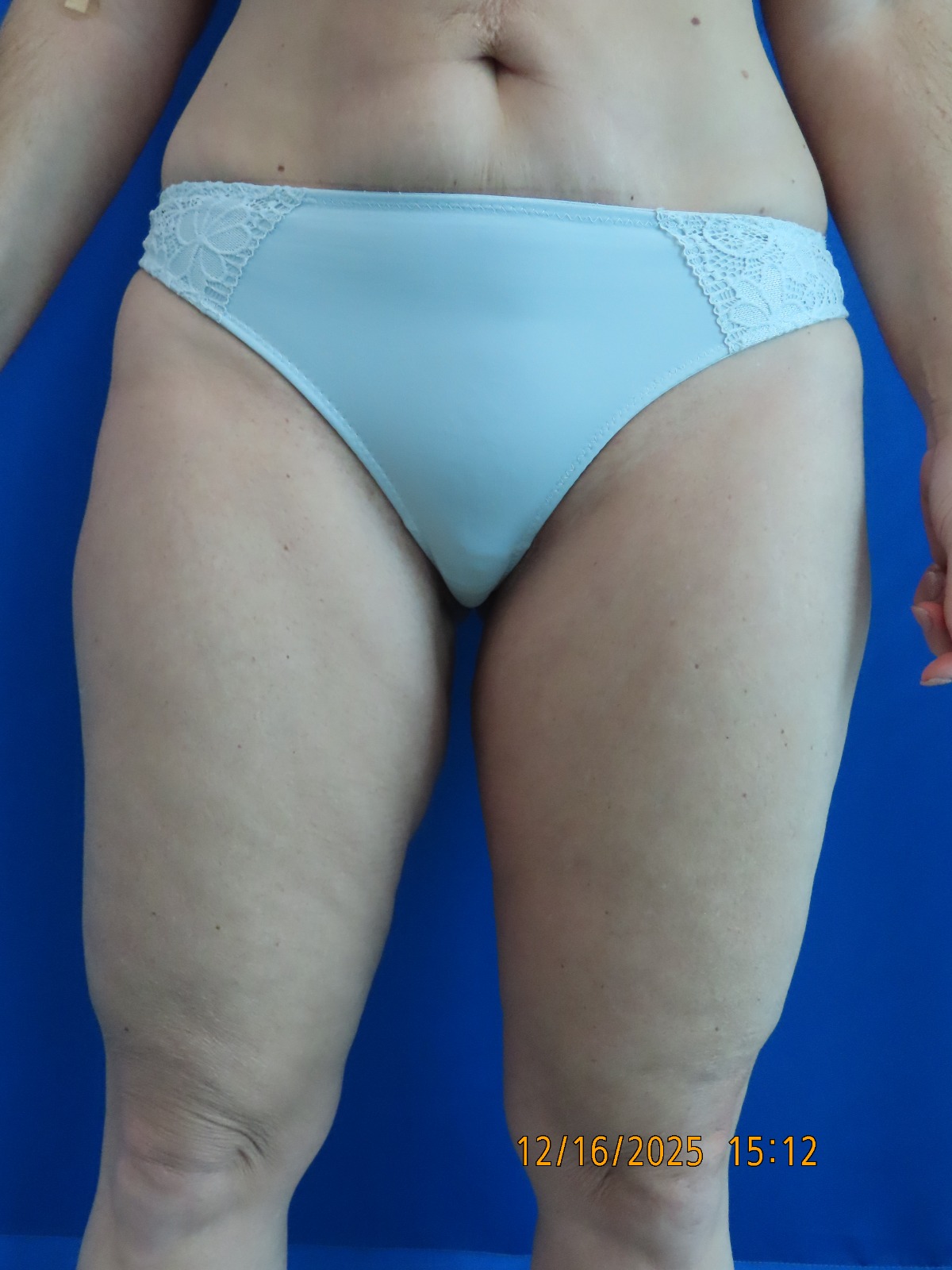 WhatsApp Image 2026-03-06 at 3.01.23 PM